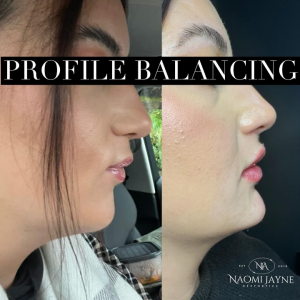 Profile Balancing