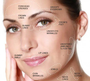 Anti Wrinkle (3 Areas)